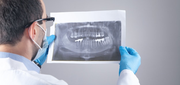 Médico caucásico sosteniendo en la imagen de rayos x de los dientes.