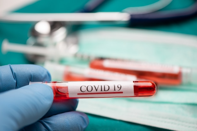 Médico com as mãos segurando o sangue para teste do Coronavírus COVID 19. Fechar-se