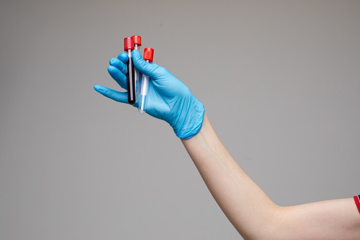 Foto médico com exames de sangue no tubo.
