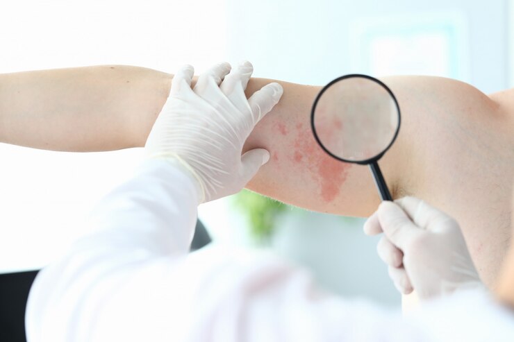 Foto médico com luvas olhando erupção cutânea com lupa