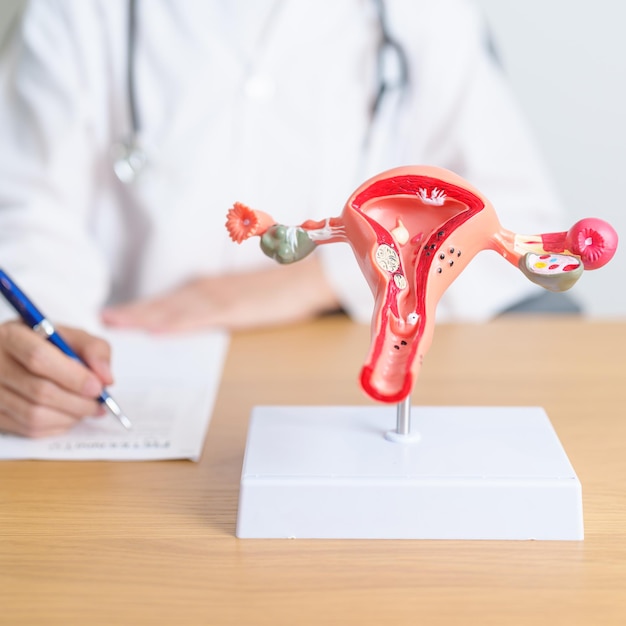 Médico com modelo de anatomia do útero e dos ovários Câncer de ovário e do colo do útero Distúrbio do pescoço do útero Endo