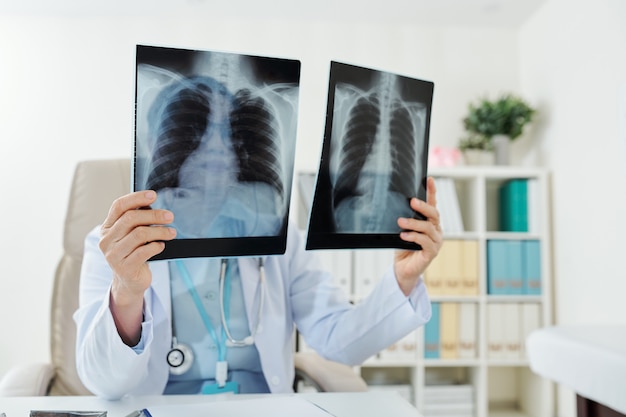 Médico comparando radiografias de pulmões