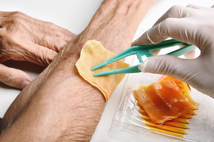 Médico curativo limpando e lavando feridas infectadas.