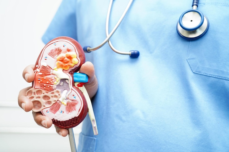 Foto médico de doença renal crónica com modelo de tratamento urologia do sistema urinário estimado