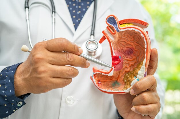 Foto médico de doenças estomacais segurando um modelo de anatomia para estudo, diagnóstico e tratamento no hospital