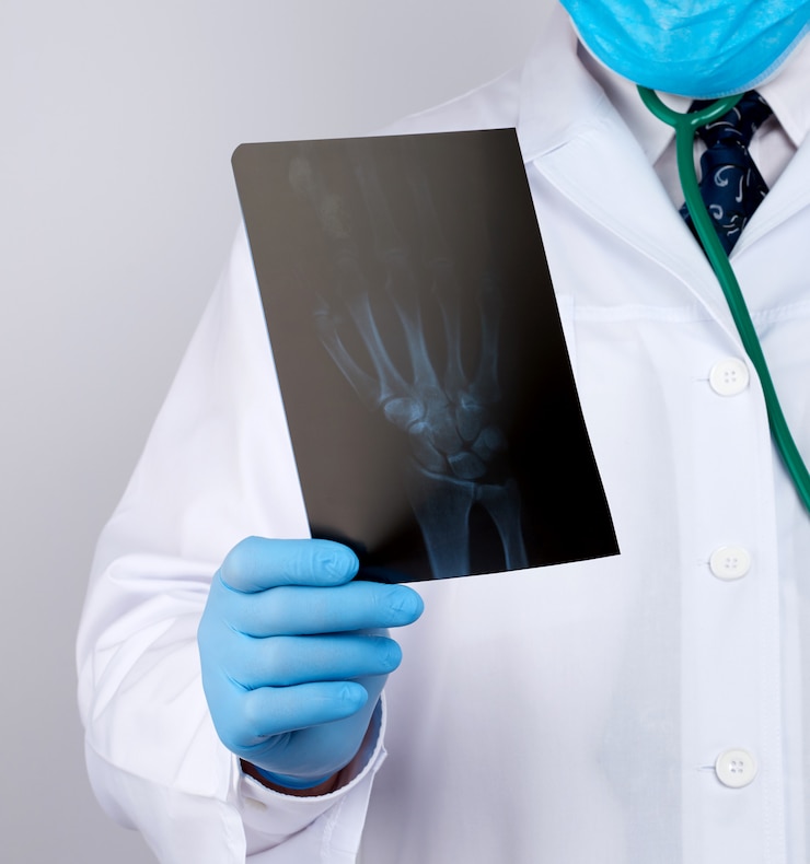 Foto médico de jaleco branco e luvas azuis de látex realiza um raio-x da mão de um homem e realiza um exame visual