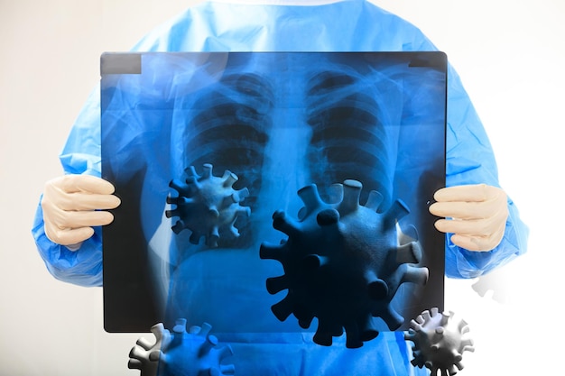 Foto médico de problemas respiratórios de infecção por coronavírus de gripe segurando uma ilustração 3d de raios x dos pulmões