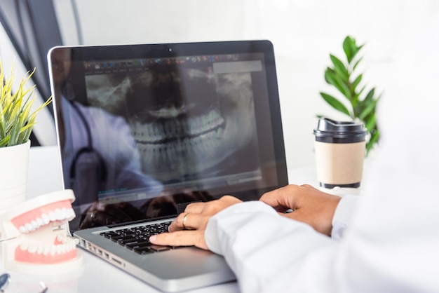 Médico dentista ou enfermeira de uniforme usa software oral dentes Xray e digita o formulário de histórico médico de informações no laptop