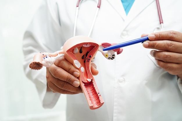 Foto médico do útero segurando modelo de anatomia para estudo, diagnóstico e tratamento no hospital