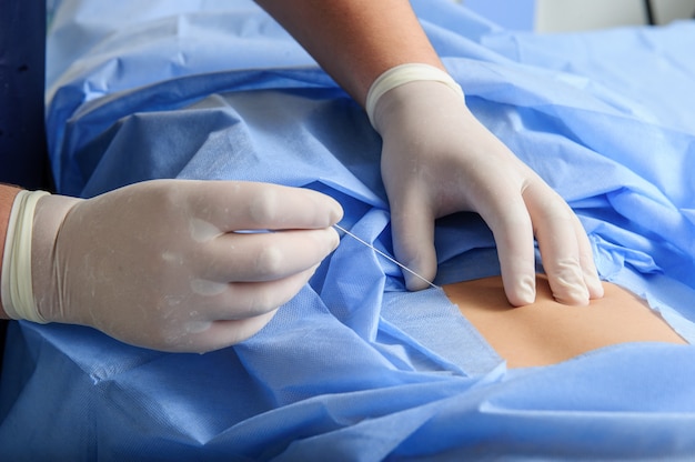 Médico durante a sutura ferida na sala de cirurgia.