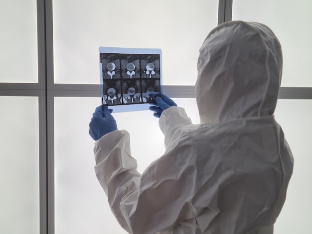 Foto médico em traje de proteção examina raio-x na clínica