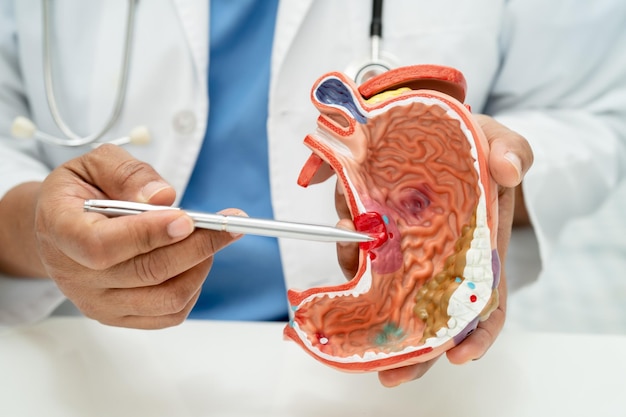 Médico de enfermedades estomacales con modelo de anatomía humana para el estudio de diagnóstico y tratamiento en el hospital