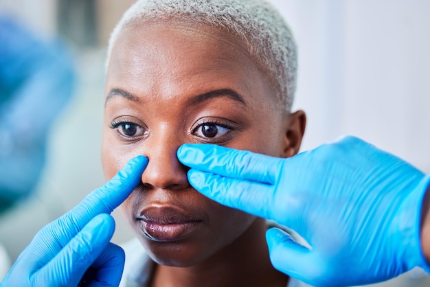 Médico entrega mulher e cirurgia plástica para transformação estética e facial de cosméticos ou plástica no nariz Trabalhador médico com rinoplastia de paciente africano ou ajuda ou suporte de dermatologia facial do cliente