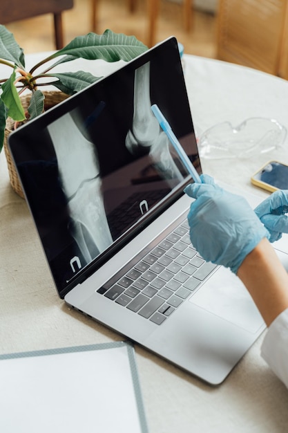 Un médico está usando una computadora portátil con un hueso en la pantalla.