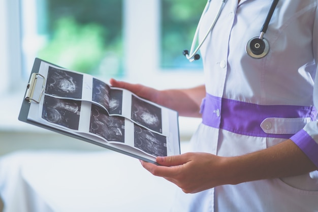 El médico examina las imágenes de ultrasonido del paciente después de la ecografía durante un control de salud y una consulta médica