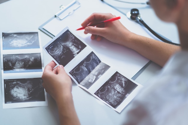 Médico examina imagens de ultrassom do paciente após ultrassonografia durante exame e consulta de saúde