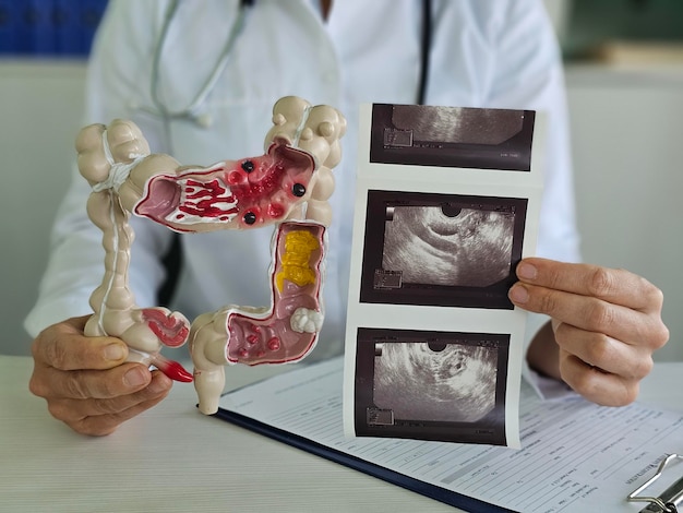 El médico examina un modelo de colon y imágenes de ultrasonido