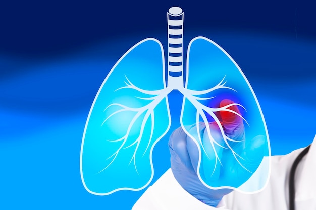 El médico examina los pulmones humanos dañados. El concepto de prevención de enfermedades de tuberculosis, cáncer de pulmón, neumonía, infección por coronavirus. foto de alta calidad