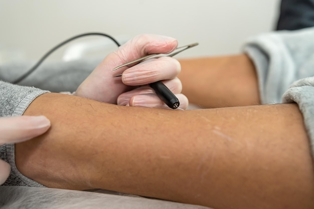 Médico fazendo procedimento de eletrodepilação para remoção de pêlos indesejados das pernas da mulher no gabinete médico Estilo de vida saudável