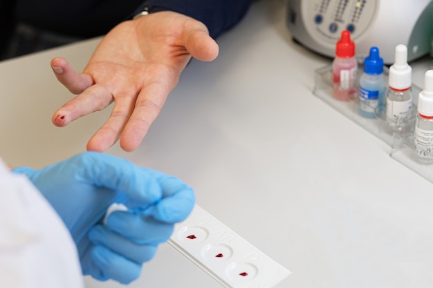 Foto médico fazendo uma análise, teste com o dedo do paciente para determinar o grupo sanguíneo e o fator rh no laboratório