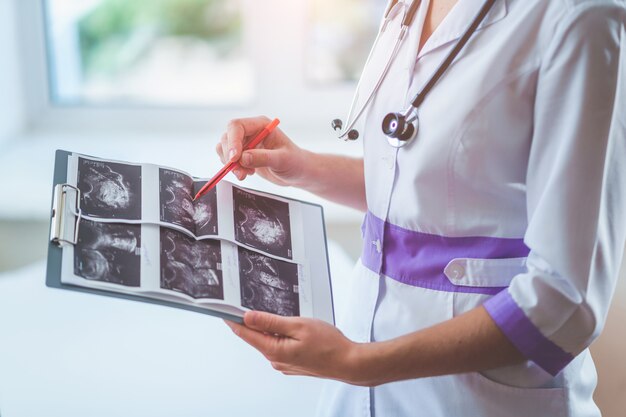 El médico general examina las imágenes de ultrasonido del paciente durante un control de salud y una consulta médica. Salud y medicina