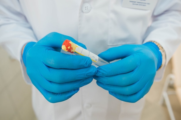 El médico con guantes azules sostiene un tubo de ensayo en sus manos Análisis de sangre