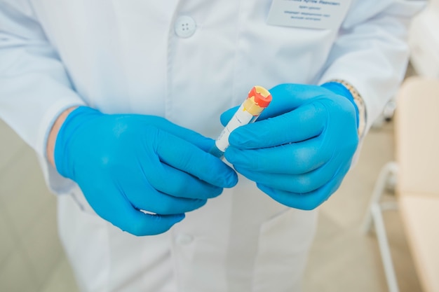 El médico con guantes azules sostiene un tubo de ensayo en sus manos Análisis de sangre