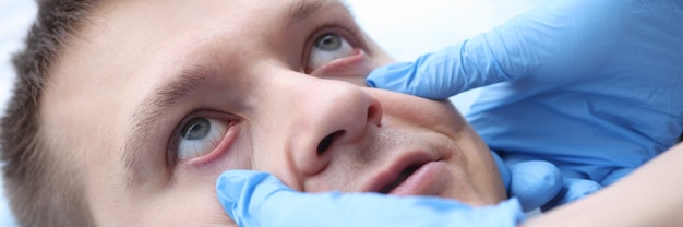 Foto médico con guantes examinando la membrana mucosa de los pacientes evaluación ocular de los pacientes