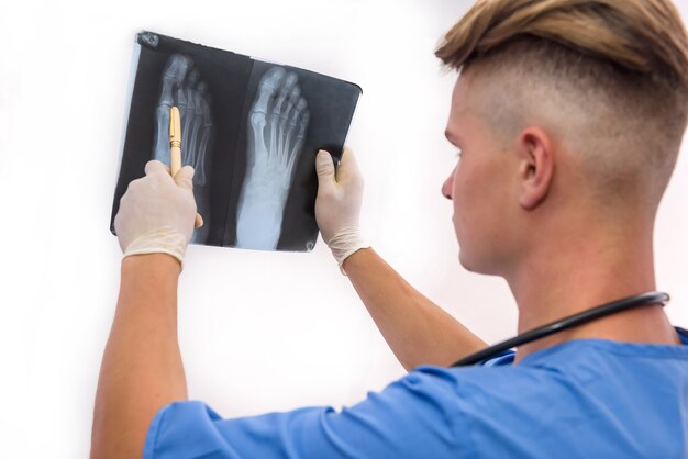 Médico guapo y joven con radiografía del pie de un paciente. Concepto de ayuda médica