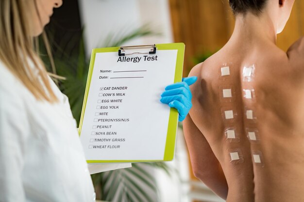 Foto médico haciendo prueba de alergia cutánea