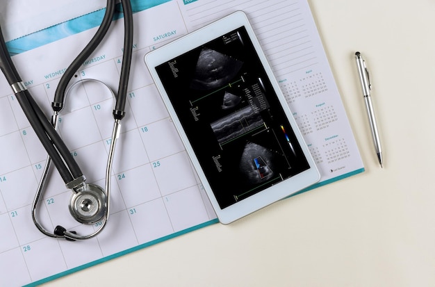 Foto médico mesa de trabajo médica con estetoscopio sobre investigación en ecografía d examen cardíaco de la palmadita