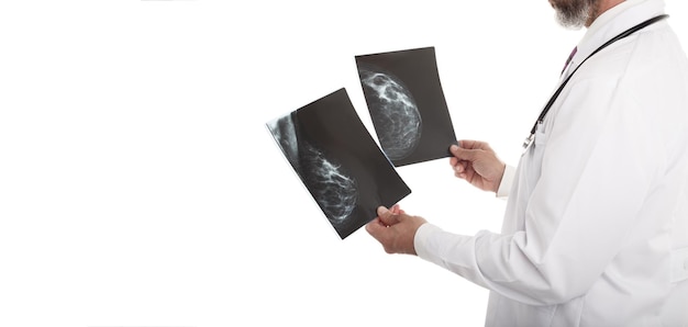 Foto el médico mirando una mamografía