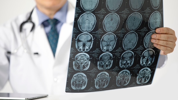 Foto un médico mirando una resonancia magnética
