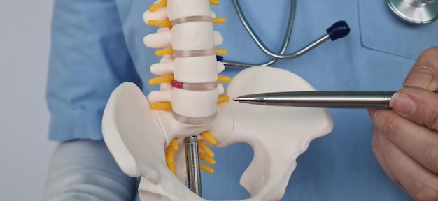 El médico muestra inflamación y dolor en los discos intervertebrales hernia de articulaciones desplazadas