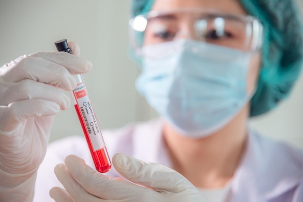 Foto un médico o científico sostiene un tubo de análisis de sangre de antígeno para la viruela del mono