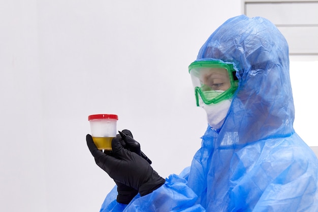 Médico o técnico mirando muestra de orina en botella preparada para examen de orina con microscopio