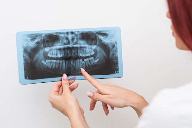 El médico ortodoncista analiza el ortopantomograma de las mandíbulas del paciente para diagnosticar