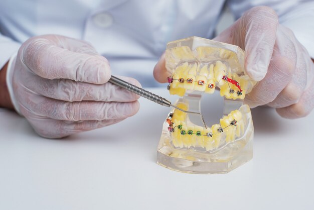 Foto médico ortodontista mostra como o sistema de aparelho nos dentes é organizado