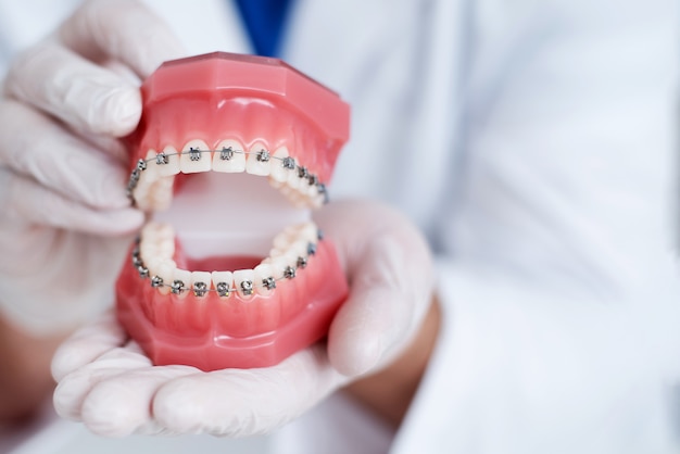 Foto médico ortodontista mostra como o sistema de aparelho nos dentes é organizado