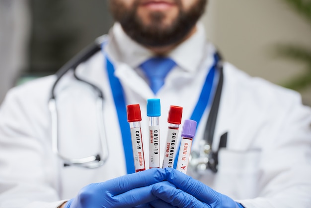 Foto un médico que muestra un banco de pruebas de tubos de sangre con coronavirus en sus manos.