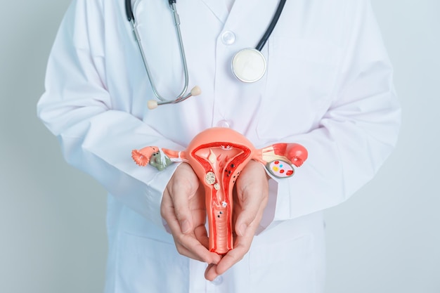 Médico que sostiene el modelo de útero y ovarios Cáncer de ovario y de cuello uterino Trastorno del cuello uterino Endometriosis Histerectomía Fibromas uterinos Sistema reproductivo y concepto de embarazo