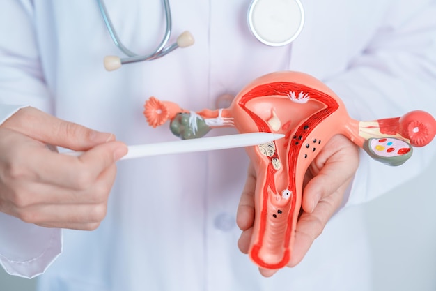 Médico segurando modelo de útero e ovários Câncer de ovário e colo do útero Distúrbio do colo do útero Endometriose Histerectomia Miomas uterinos Sistema reprodutivo e conceito de gravidez