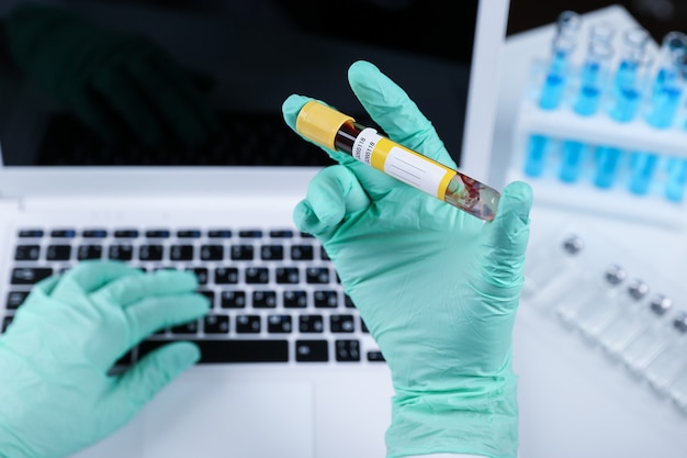 Foto médico segurando tubo de ensaio de sangue e digitando no laptop