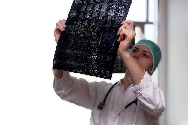 Médico segurando uma foto de um fluxo de trabalho de ressonância magnética do cérebro em um hospital de diagnóstico