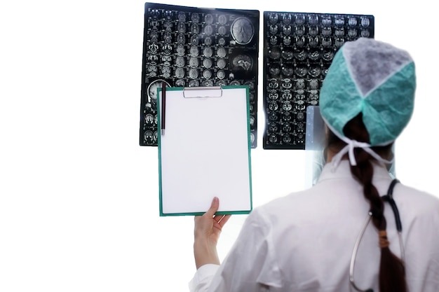 Médico segurando uma foto de um fluxo de trabalho de ressonância magnética do cérebro em um hospital de diagnóstico