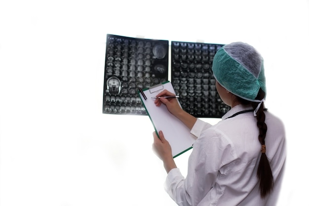 Médico segurando uma foto de um fluxo de trabalho de ressonância magnética do cérebro em um hospital de diagnóstico