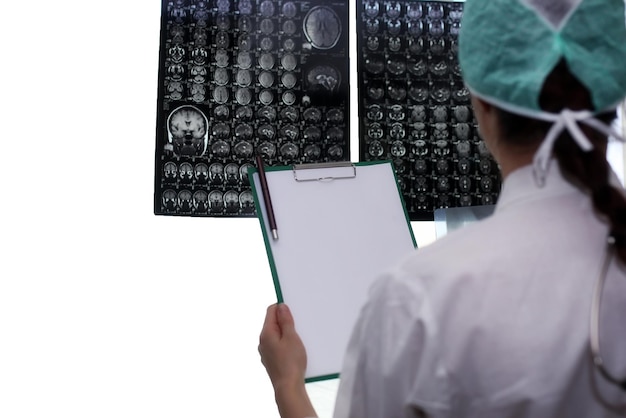 Médico sosteniendo una imagen de un flujo de trabajo de resonancia magnética cerebral en el hospital de diagnóstico