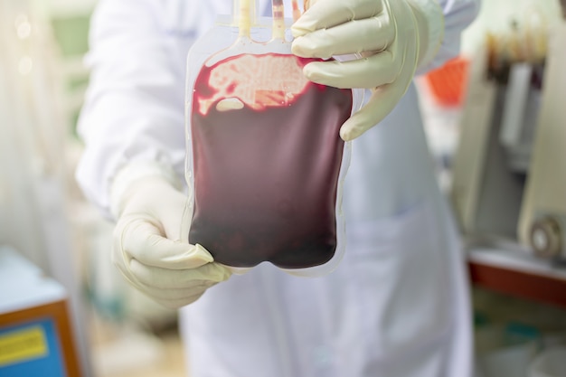 Foto el médico sostiene una bolsa de sangre para el paciente.