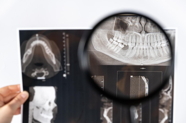 El médico sostiene una tomografía computarizada de un paciente con disfunción de la articulación temporomandibular y maloclusión