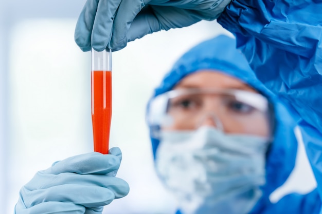 El médico con traje protector de materiales peligrosos sostiene un tubo de ensayo con una muestra de sangre con coronavirus positiva de Wuhan, China. Pandemia nCoV 2019. Detener el coronavirus. MERS